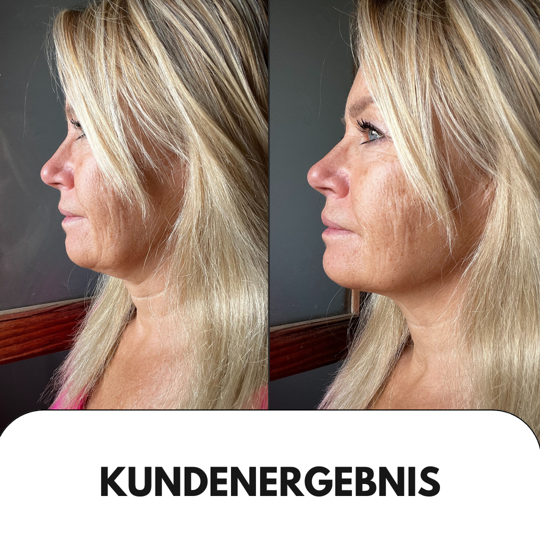BeautyRevive™ Facelifter Pro